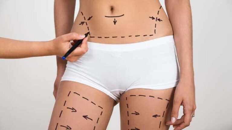 Doğumdan sonra estetik dokunuş: Anne estetik